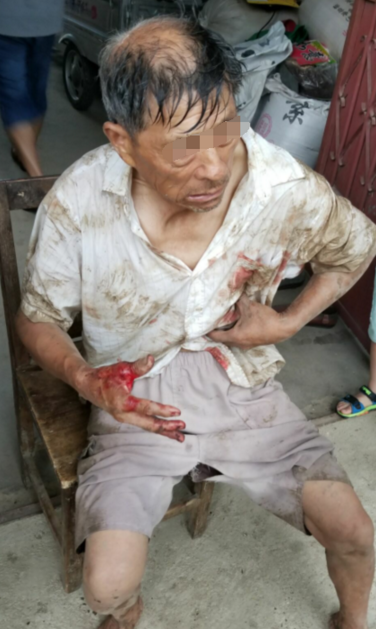 下班高峰持刀伤17人,仓配一体,时效速达