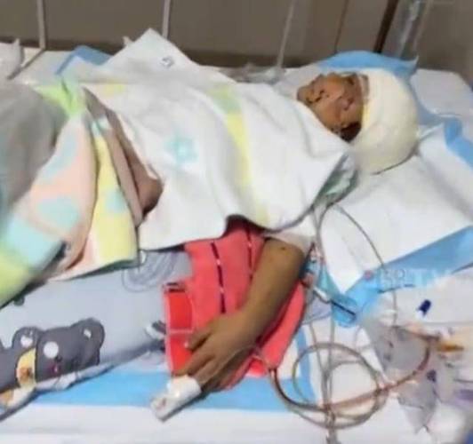 7岁男孩遭3只犬撕咬,仓配一体,时效速达