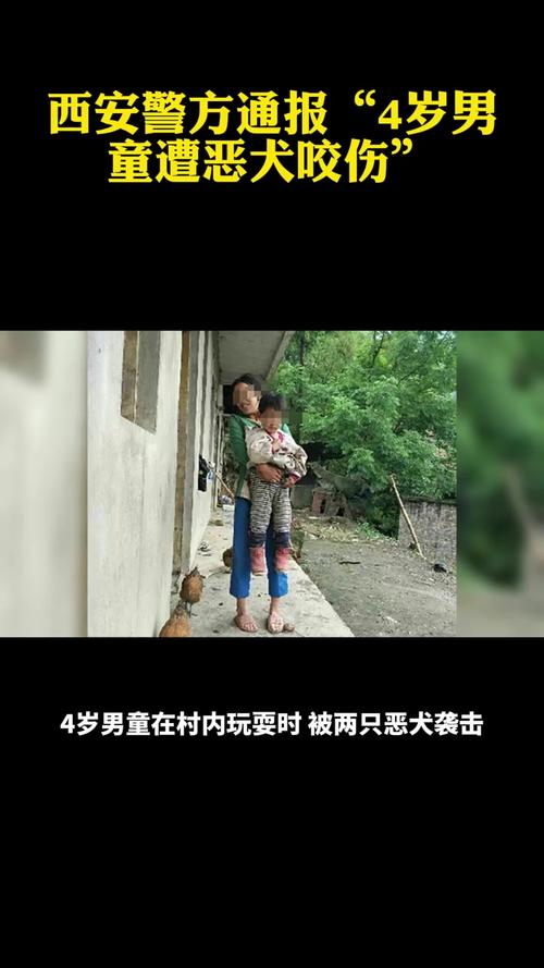 7岁男孩遭3只犬撕咬,物流专线直达_123随叫随到