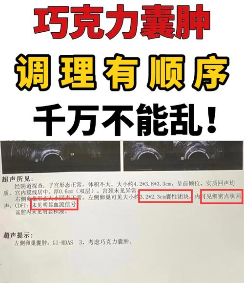 这些食物是湿气之源,快递单号查询_123随叫随到