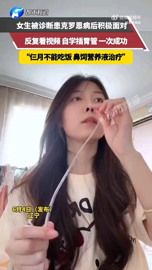 00后女孩自学插胃管,物流专线直达_123随叫随到