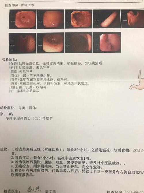 胃炎被当癌症切全胃,专业的一站式物流信息网_123随叫随到